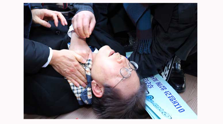 leader Lee Jae-myung is seen after he was injured in Busan, South Korea,